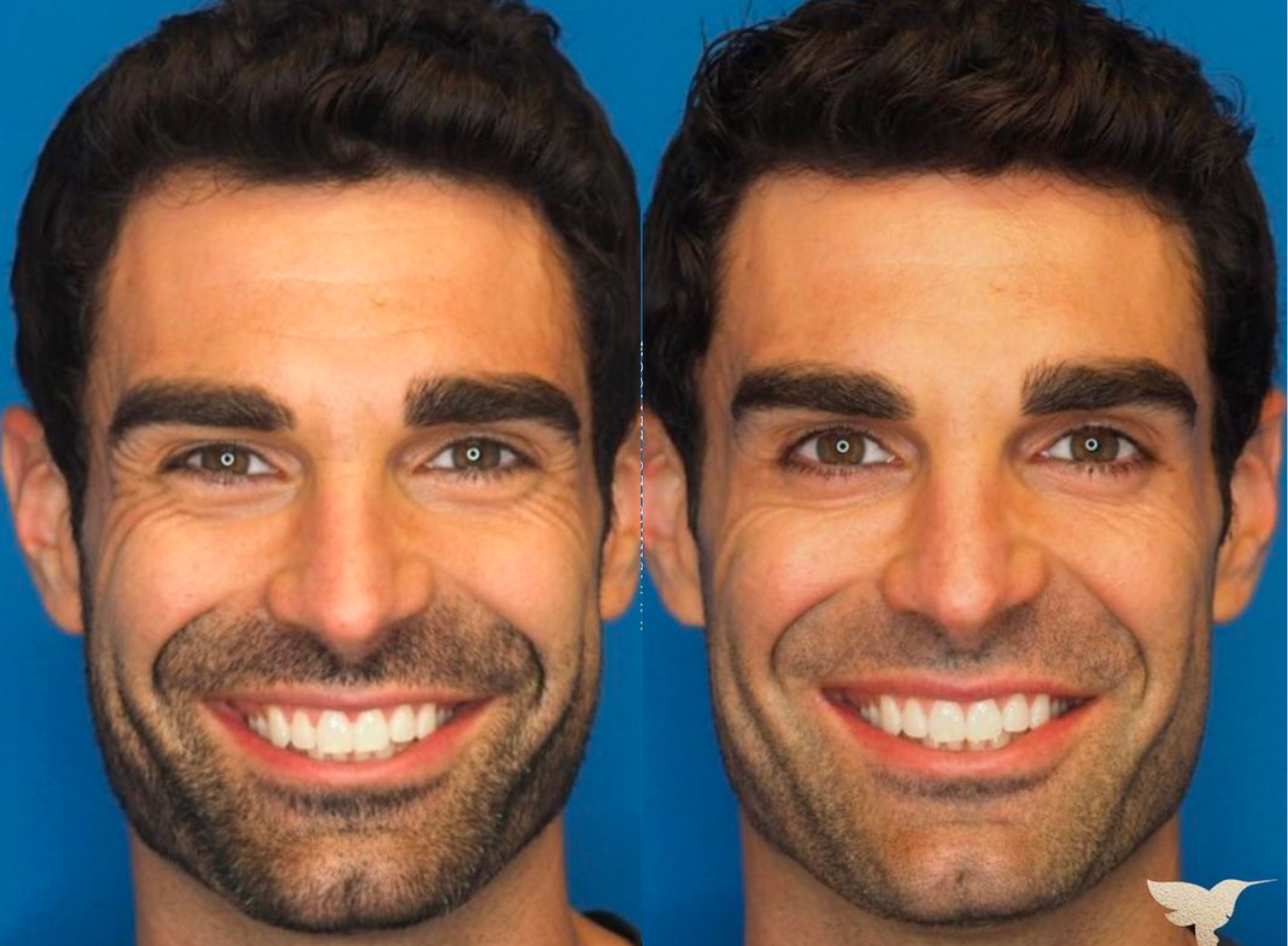 Kit 10 Años Menos For Men