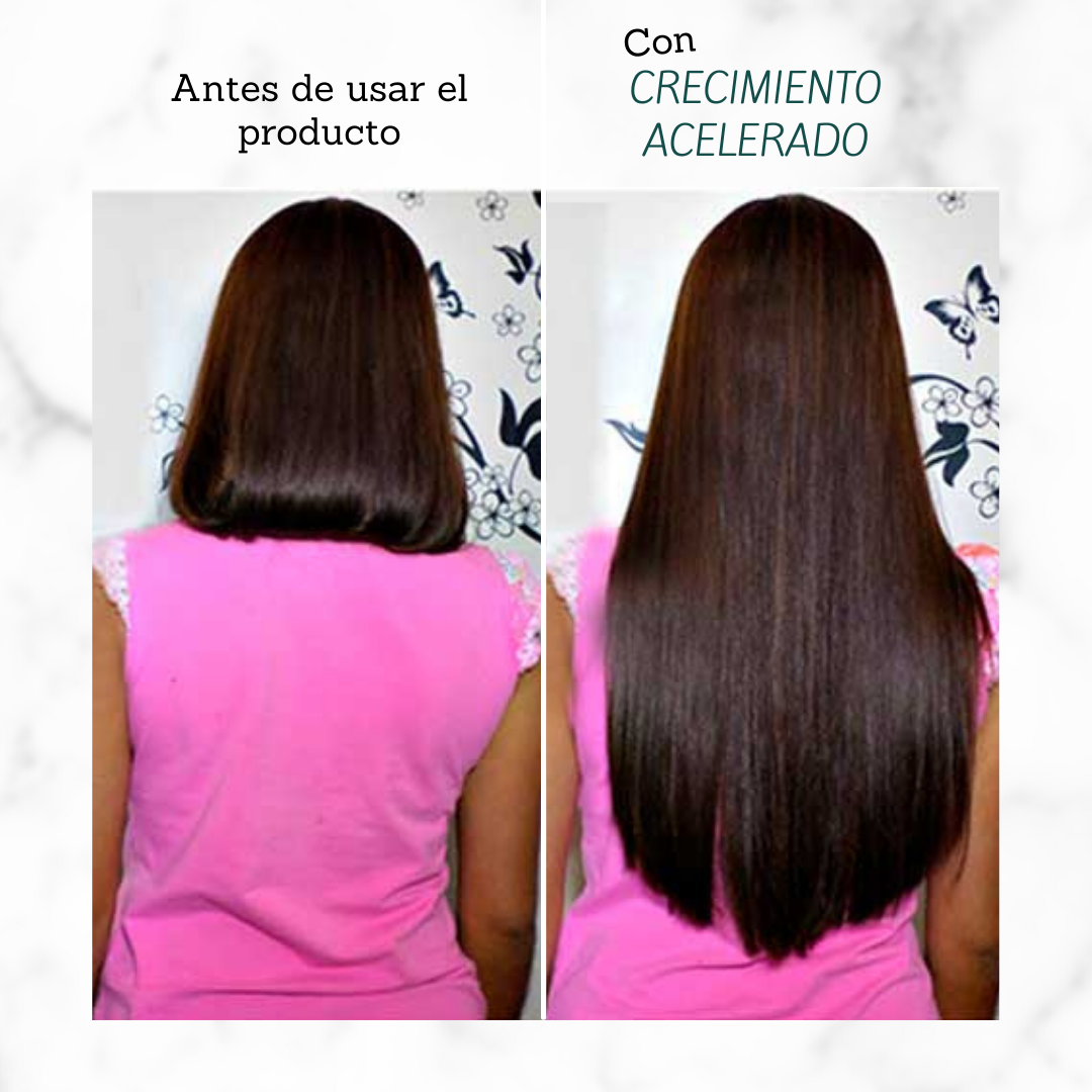 Shampoo Crecimiento Acelerado JEHESMIPA