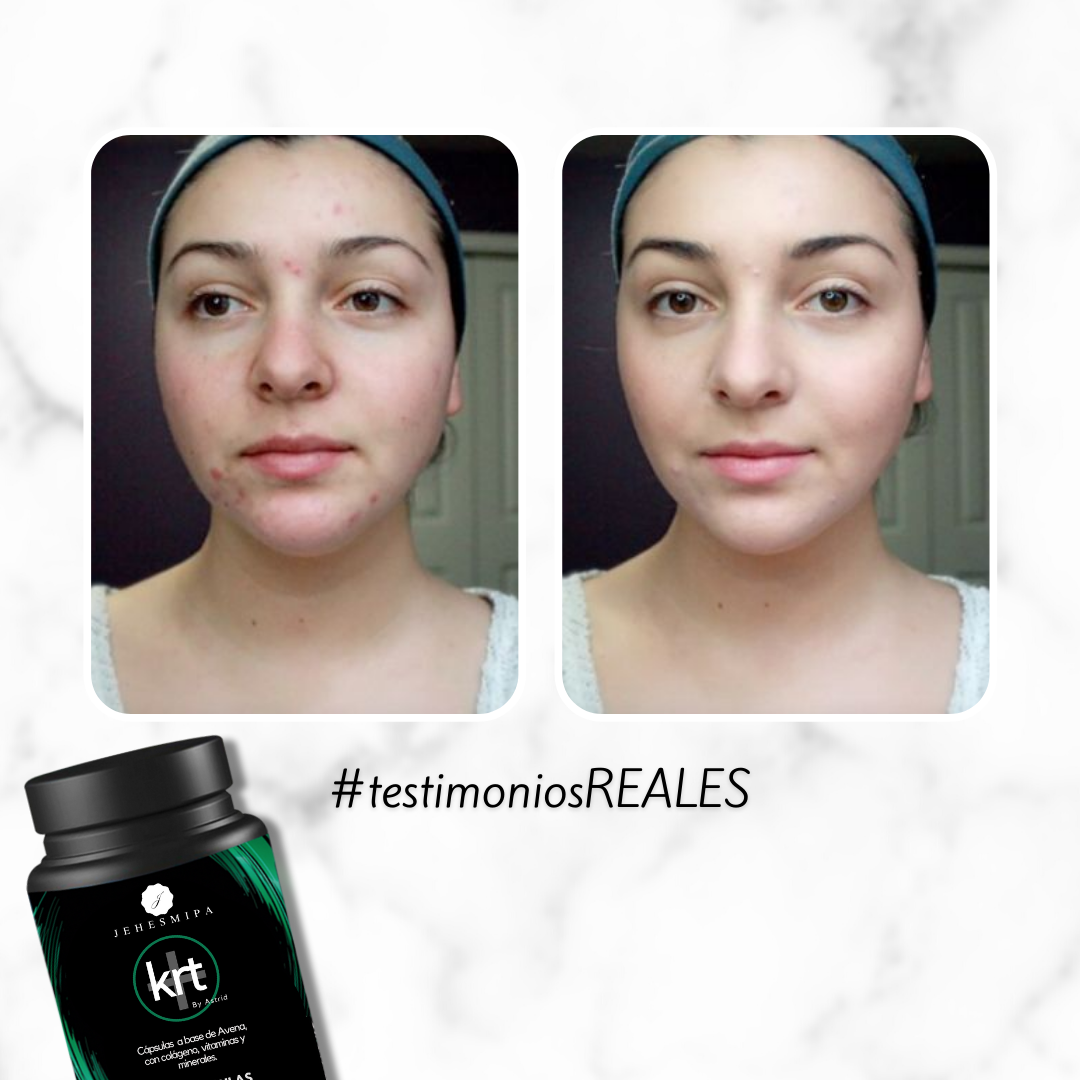 Kit 10 Cápsulas Bio colagen + Keratin