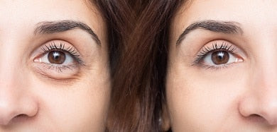 Gel tensor contorno de ojos
